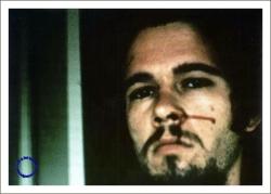 Bloody Nose, 1973